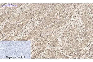 Immunohistochemical analysis of paraffin-embedded human uterus tissue. (BMP2 antibody  (C-Term))