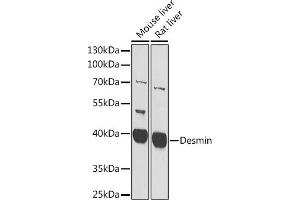 Western blot analysis of extracts of C2C12 cells, using Desmin antibody  at 1:400 dilution. (Desmin antibody  (AA 1-200))