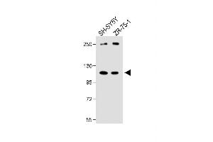 All lanes : Anti-PCDHA8 Antibody (C-term) at 1:1000 dilution Lane 1: SH-SY5Y whole cell lysate Lane 2: ZR-75-1 whole cell lysate Lysates/proteins at 20 μg per lane. (PCDHa8 antibody  (C-Term))