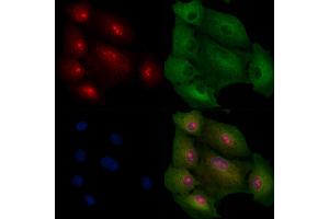 ABIN6257837 and ABIN6275222 staining  cells by IF/ICC.