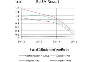 Black line: Control Antigen (100 ng),Purple line: Antigen (10 ng), Blue line: Antigen (50 ng), Red line:Antigen (100 ng) (IL-1 beta antibody  (AA 117-269))