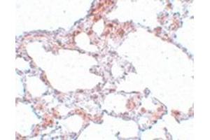 Immunohistochemical staining of rat lung tissue with MRE11A polyclonal antibody  at 5 ug/mL dilution.
