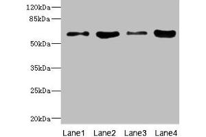 Western blot All lanes: PIP5K1A antibody at 4. (PIP5K1A antibody  (AA 293-562))