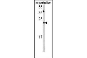 Figure 1. (Glutaredoxin 2 antibody  (C-Term))