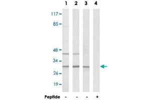 Western blot analysis of extracts from COLO cells (Lane 1), HeLa cells (Lane 2) and HUVEC cells (Lane 3 and lane 4), using RPS4Y1 polyclonal antibody .