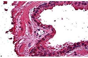 Human Prostate, Epithelium: Formalin-Fixed, Paraffin-Embedded (FFPE) (ERN1 antibody  (AA 401-500))