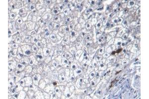 Detection of S100A8 in Human Liver Tissue using Monoclonal Antibody to S100 Calcium Binding Protein A8 (S100A8) (S100A8 antibody  (AA 1-93))