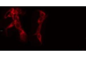 ABIN6272312 staining 293 cells by IF/ICC. (GRAP antibody)