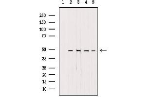 Western blot analysis of extracts from various samples, using AP1M1 antibody. (AP1M1 antibody  (Internal Region))