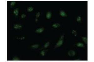 Immunostaining analysis in HeLa cells. (ORC6 antibody)