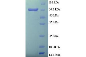 SDS-PAGE (SDS) image for D-2-Hydroxyglutarate Dehydrogenase (D2HGDH) (AA 56-533) protein (His-SUMO Tag) (ABIN5711141) (D2HGDH Protein (AA 56-533) (His-SUMO Tag))