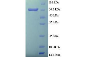 SDS-PAGE (SDS) image for D-2-Hydroxyglutarate Dehydrogenase (D2HGDH) (AA 56-533) protein (His-SUMO Tag) (ABIN5711141)
