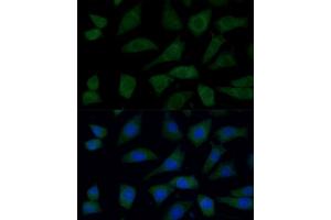 Immunofluorescence analysis of L929 cells using FGD1 Polyclonal Antibody (ABIN7267284) at dilution of 1:100 (40x lens).