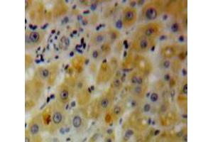 Used in DAB staining on fromalin fixed paraffin-embedded Liver tissue (PHLDA2 antibody  (AA 1-152))