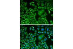 Immunofluorescence analysis of HeLa cells using ACTR3 antibody.
