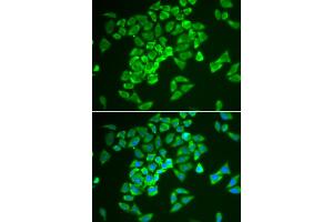 Immunofluorescence analysis of A549 cells using KEAP1 antibody.