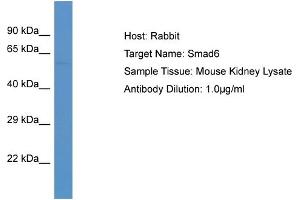 Host: Rabbit Target Name: SMAD6 Sample Tissue: Mouse Kidney Antibody Dilution: 1ug/ml (SMAD6 antibody  (C-Term))