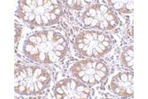 Immunohistochemistry of CD248 in human colon tissue with CD248 polyclonal antibody  at 2.