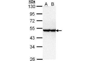 WB Image Sample (30 ug of whole cell lysate) A: Hela B: Hep G2 , 10% SDS PAGE antibody diluted at 1:1000 (STK40 antibody)