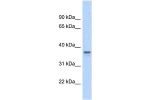 WB Suggested Anti-GAPDH Antibody Titration: 0. (GAPDH antibody  (Middle Region))