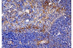 IHC analysis of CCR6 using anti-CCR6 antibody (ABIN7603110). (CCR6 antibody  (N-Term))