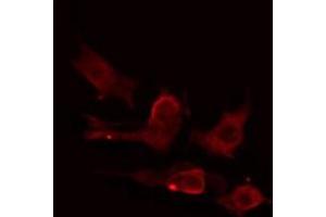 ABIN6275224 staining HuvEc cells by IF/ICC. (MIA2 antibody  (C-Term))