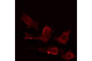 ABIN6275224 staining HuvEc cells by IF/ICC. (MIA2 antibody  (C-Term))