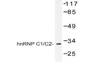 Western blot (WB) analysis of hnRNP C1/C2 antibody in extracts from HepG2 cells. (HNRNPC antibody)