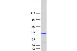 Western Blotting (WB) image for B-Cell CLL/lymphoma 11A (Zinc Finger Protein) (BCL11A) (Transcript Variant 3) protein (Myc-DYKDDDDK Tag) (ABIN2715190)