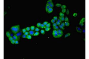 Immunofluorescent analysis of PC-3 cells using ABIN7159273 at dilution of 1:100 and Alexa Fluor 488-congugated AffiniPure Goat Anti-Rabbit IgG(H+L) (MAGEA8 antibody  (AA 1-270))
