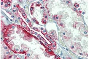 Kidney, Human: Formalin-Fixed, Paraffin-Embedded (FFPE)