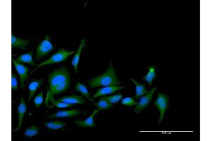 Immunofluorescence (IF) image for anti-Protein Phosphatase 1, Regulatory (Inhibitor) Subunit 2 (PPP1R2) (AA 1-205) antibody (ABIN519102)