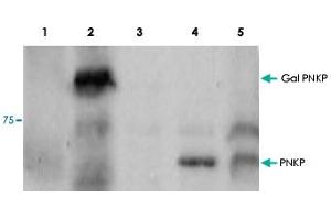 Western blot using PNKP polyclonal antibody  shows detection of a 57 kDa band corresponding to : Lane 1, human PNKP in a Y190 yeast cell lysate. (PNKP antibody  (Internal Region))