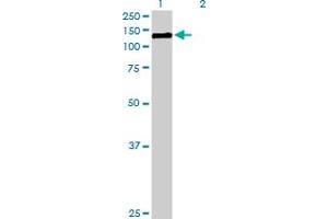 Western Blot analysis of CDH3 expression in transfected 293T cell line by CDH3 MaxPab polyclonal antibody. (P-Cadherin antibody  (AA 1-829))