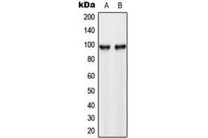 Western blot analysis of Hexokinase 3 expression in HL60 (A), HeLa (B) whole cell lysates.