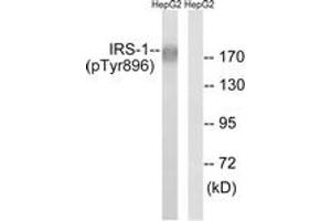 Western blot analysis of extracts from HepG2 cells treated with Na3VO4 0. (IRS1 antibody  (pTyr896))