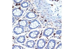 Immunohistochemistry of paraffin-embedded human colon using Mast Cell Tryptase (TPSB2) (TPSB2) Rabbit mAb (ABIN7271017) at dilution of 1:100 (40x lens). (TPSB2 antibody)
