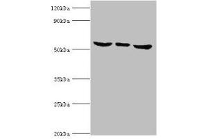 Western blot All lanes: MAPK15 antibody at 6 μg/mL Lane 1: Hela whole cell lysate Lane 2: MCF-7 whole cell lysate Lane 3: HepG2 whole cell lysate Secondary Goat polyclonal to rabbit IgG at 1/10000 dilution Predicted band size: 60, 29, 32 kDa Observed band size: 60 kDa (MAPK15 antibody  (AA 1-95))