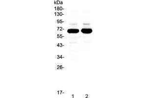 Western blot testing of 1) rat brain and 2) mouse brain lysate with SF1 antibody at 0. (Splicing Factor 1 antibody)