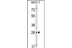 Western blot analysis of RASL11B Antibody (N-term) (ABIN652737 and ABIN2842488) in MCF-7 cell line lysates (35 μg/lane). (RASL11B antibody  (N-Term))