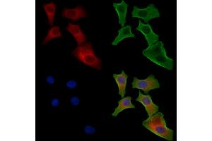 ABIN6257016 and ABIN6274443 staining Hela cells by IF/ICC. (EPS8-Like 1 antibody  (Internal Region))