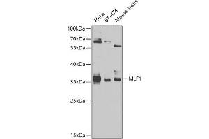 Western blot analysis of extracts of various cell lines, using MLF1 antibody (ABIN6128238, ABIN6143875, ABIN6143877 and ABIN6224035) at 1:1000 dilution. (MLF1 antibody  (AA 1-268))