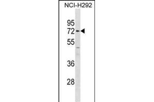 P14 Antibody (C-term) (ABIN1881546 and ABIN2838848) western blot analysis in NCI- cell line lysates (35 μg/lane). (MMP14 antibody  (C-Term))