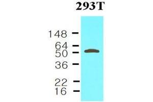 Cell lysates of 293T (30 ug) were resolved by SDS-PAGE, transferred to nitrocellulose membrane and probed with anti-human Visfatin (1:1000). (NAMPT antibody  (AA 1-491))