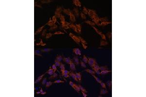 Immunofluorescence analysis of C6 cells using ENOX2 antibody (ABIN6129374, ABIN6140176, ABIN6140178 and ABIN6222855) at dilution of 1:100.
