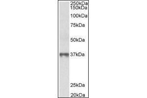 MAT2B  Antibody staining of Human Thymus lysate at 0. (MAT2B antibody  (Isoform 1, N-Term))