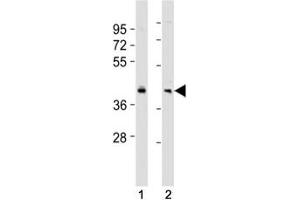 Western Blotting (WB) image for anti-BMI1 Polycomb Ring Finger Oncogene (BMI1) (AA 230-265) antibody (ABIN3030166)