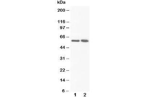 Western blot testing of FMO3 antibody and Lane 1:  rat liver;  2: rat liver
