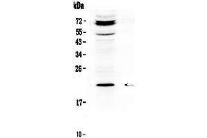 Western blot analysis of C19orf80 using anti-C19orf80 antibody . (C19ORF80 antibody  (AA 22-198))