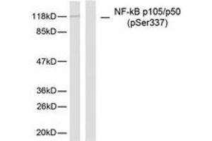 Western blot analysis of extracts from MDA-MB-435 cells, using NF-kappaB p105/p50 (Phospho-Ser337) Antibody.